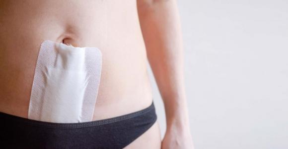 chirurgie gynécologique